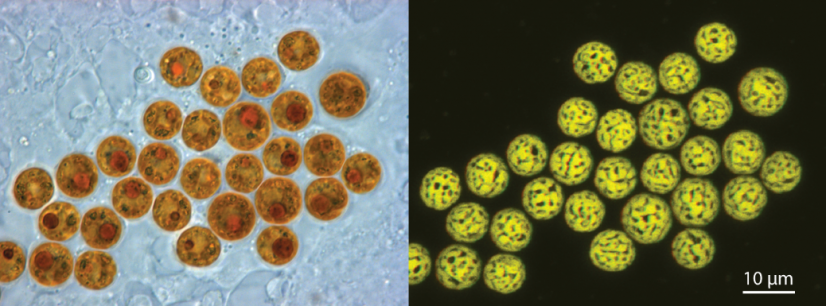 Light and confocal images of Symbiodinium cells living in a host cell. (Photo Credit: Allisonmlewis / CC BY-SA)